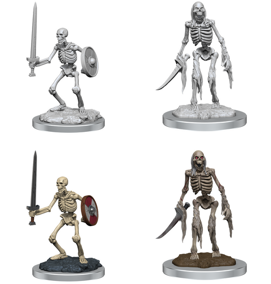 Wizkids - Skeletons